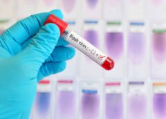 Dịch cúm virus Nipah bùng phát tại Ấn Độ; tỷ lệ tử vong lên đến 75%